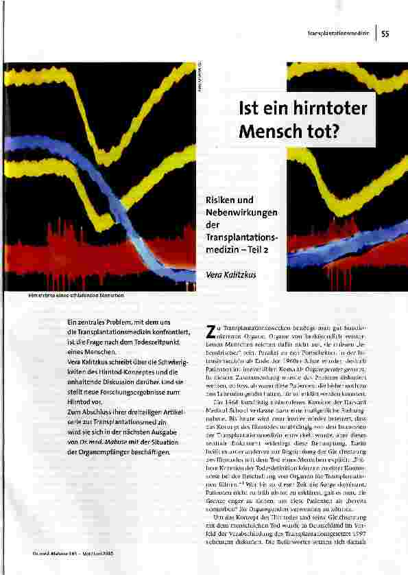 Ist ein hirntoter Mensch tot?